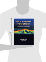 Optical Coherence Tomography