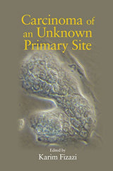 Carcinoma of an Unknown Primary Site: 1st Edition