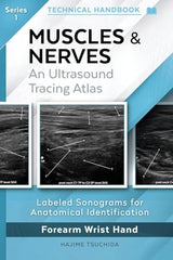 Muscles & Nerves - Technical Ultrasound Handbook: An Ultrasound Tracing Atlas (Series 1) (Technical Ultrasound Handbook - Muscles & Nerves: An Ultrasound Tracing Atlas)