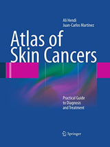 Atlas of Skin Cancers: Practical Guide to Diagnosis and Treatment