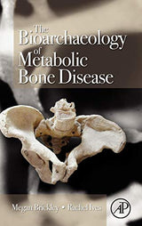 The Bioarchaeology of Metabolic Bone Disease: 1st Edition
