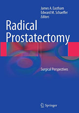 Radical Prostatectomy: Surgical Perspectives