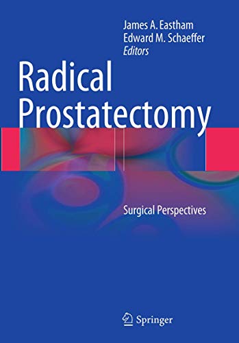Radical Prostatectomy: Surgical Perspectives