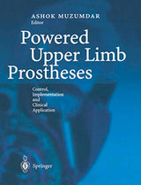 Powered Upper Limb Prostheses: Control, Implementation and Clinical Application