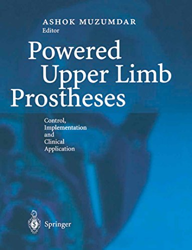 Powered Upper Limb Prostheses: Control, Implementation and Clinical Application