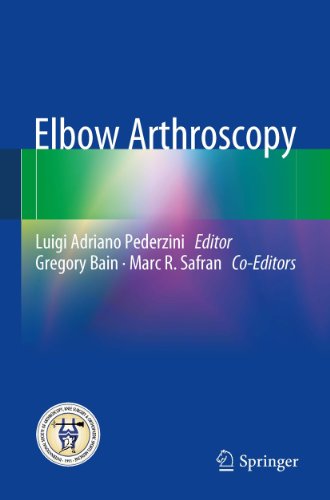 Elbow Arthroscopy: 2013th Edition, Kindle Edition