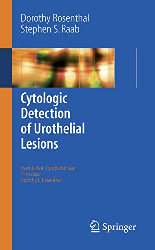 Cytologic Detection of Urothelial Lesions (Essentials in Cytopathology, 2): First Edition