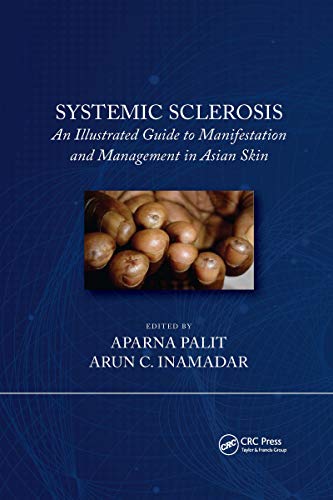 Systemic Sclerosis: 1st Edition