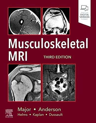 Musculoskeletal MRI: 3rd Edition