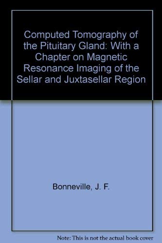 Computed Tomography Of The Pituitary Gland