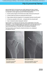 Accident and Emergency Radiology: A Survival Guide