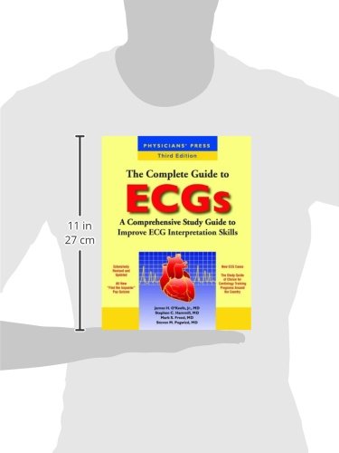 The Complete Guide to ECGs:.