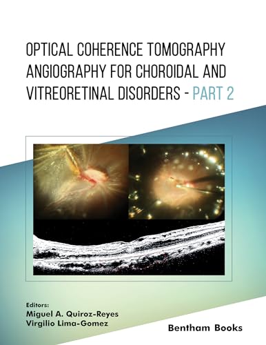 Optical Coherence Tomography Angiography for Choroidal and Vitreoretinal Disorders – Part 2