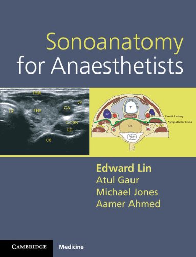 Sonoanatomy for Anaesthetists (Cambridge Medicine ()): 1st Edition