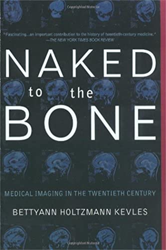 Naked To The Bone: Medical Imaging In The Twentieth Century