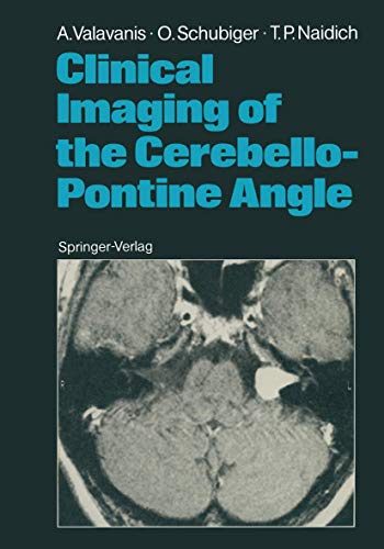 Clinical Imaging of the Cerebello-Pontine Angle: 1st Edition