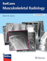 RadCases Q&A Musculoskeletal Radiology (Radcases Plus Q&A): 2nd Edition