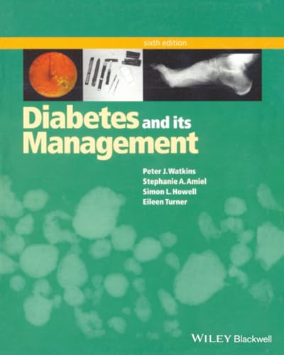 Diabetes and Its Management: 6th Edition