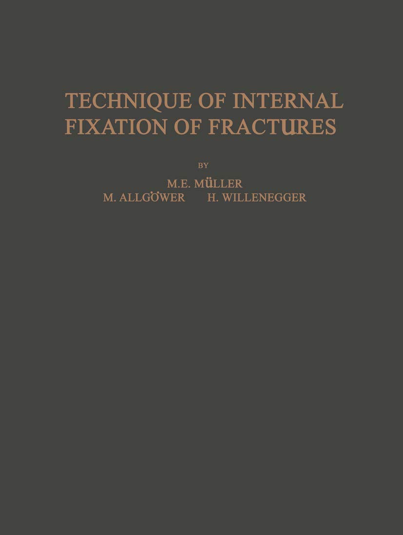 Technique of Internal Fixation of Fractures