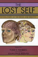 The Lost Self: Pathologies of the Brain and Identity
