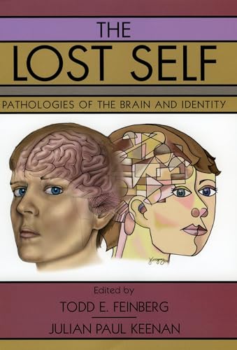 The Lost Self: Pathologies of the Brain and Identity