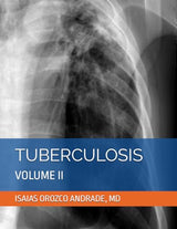 TUBERCULOSIS: VOLUME II (TUBERCULOSIS 2024. THIRD ENGLISH EDITION)