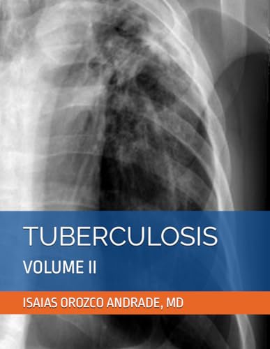 TUBERCULOSIS: VOLUME II (TUBERCULOSIS 2024. THIRD ENGLISH EDITION)