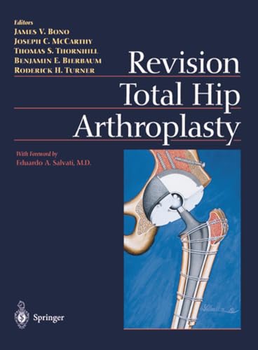 Revision Total Hip Arthroplasty: 1st Edition