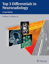 Top 3 Differentials in Neuroradiology: A Case Review