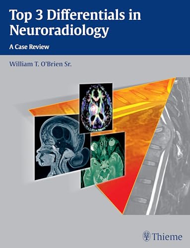 Top 3 Differentials in Neuroradiology: A Case Review