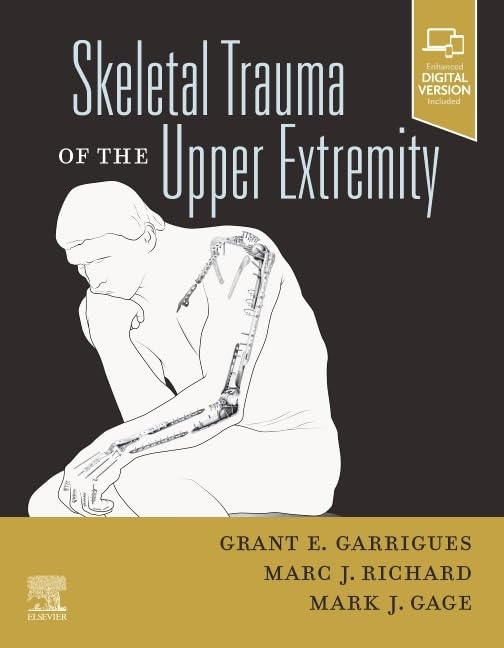 Skeletal Trauma of the Upper Extremity: 1st Edition