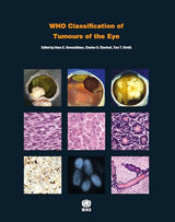 WHO Classification of Tumours of the Eye [OP]: 4th Edition