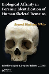 Biological Affinity in Forensic Identification of Human Skeletal Remains: Beyond Black and White