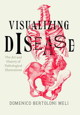 Visualizing Disease: The Art and History of Pathological Illustrations: Illustrated Edition, Kindle Edition
