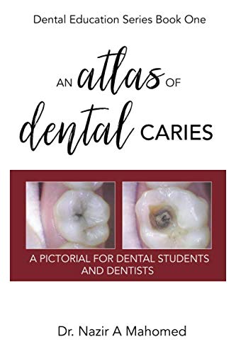 An Atlas of Dental Caries: A Pictorial For Dental Students and Dentists