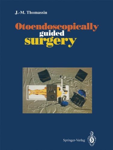 Otoendoscopically guided surgery: 1st Edition, Kindle Edition