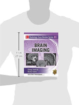 Radiology Case Review Series: Brain Imaging