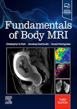 Fundamentals of Body MRI (Fundamentals of Radiology): 3rd Edition