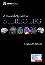 A Practical Approach to Stereo EEG: First Edition