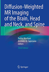 Diffusion-Weighted MR Imaging of the Brain, Head and Neck, and Spine: 3rd Edition