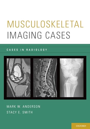 Musculoskeletal Imaging Cases in Radiology): 1st Edition