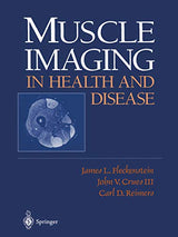 Muscle Imaging in Health and Disease: 1st Edition