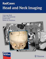 RadCases Head and Neck Imaging (Radcases Plus Q&A): 1st Edition
