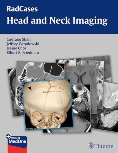 RadCases Head and Neck Imaging (Radcases Plus Q&A): 1st Edition