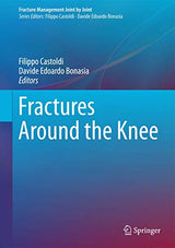 Fractures Around the Knee (Fracture Management Joint by Joint)