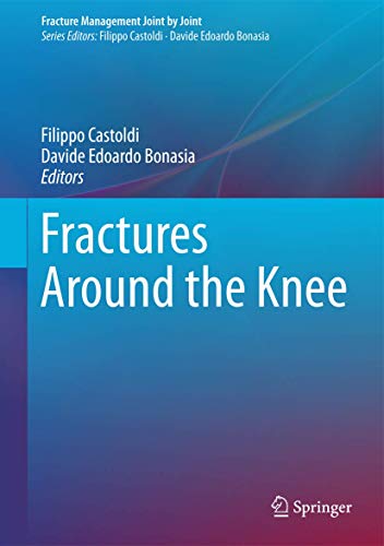 Fractures Around the Knee (Fracture Management Joint by Joint)
