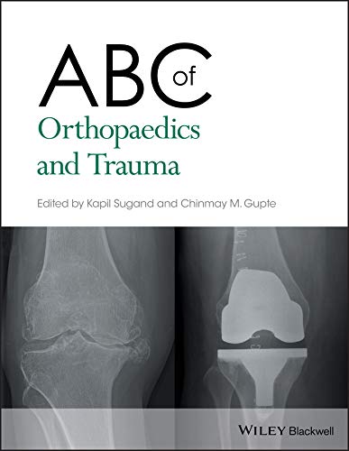 ABC of Orthopaedics and Trauma (ABC Series Book 257): 1st Edition