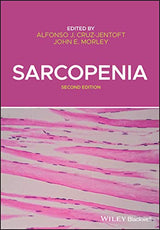 Sarcopenia: 2nd Edition
