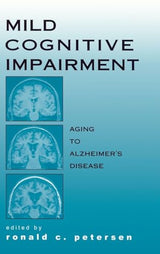 Mild Cognitive Impairment: Aging to Alzheimer's Disease