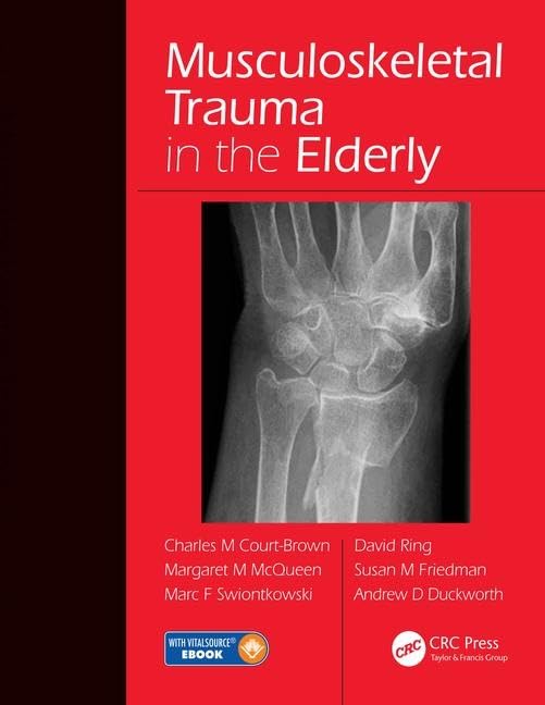 Musculoskeletal Trauma in the Elderly: 1st Edition